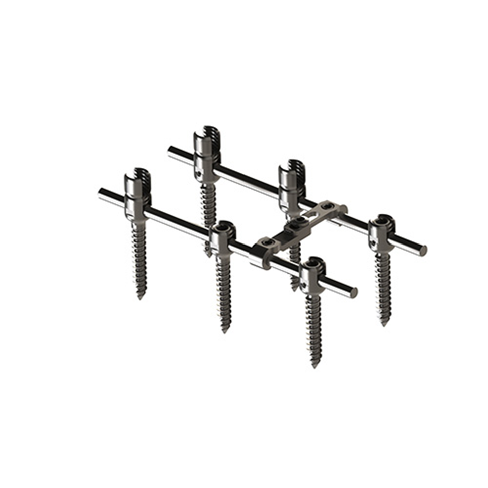 EDEN Spinal Pedicle Screw