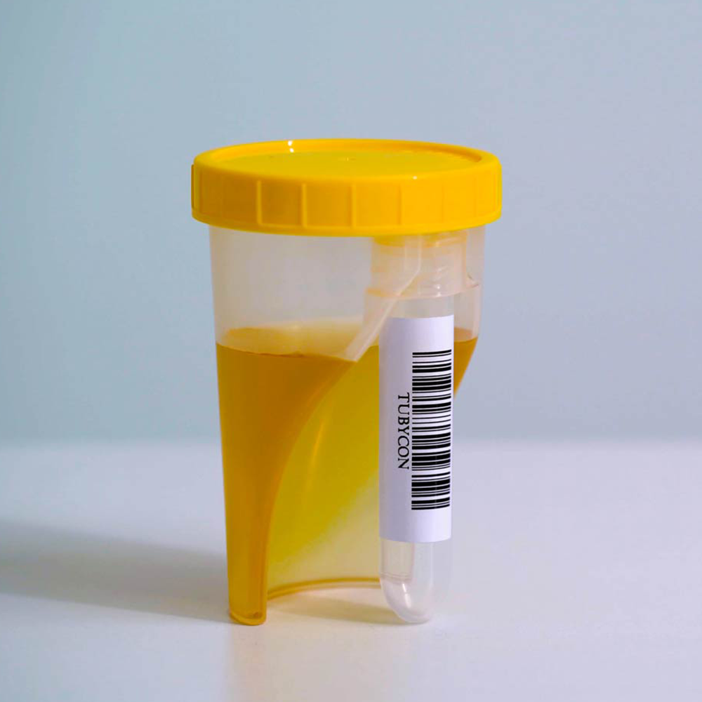 TUBYCON Single Tube Urine Test Cup Kit